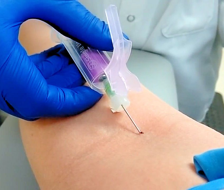 Phlebotomy image 1