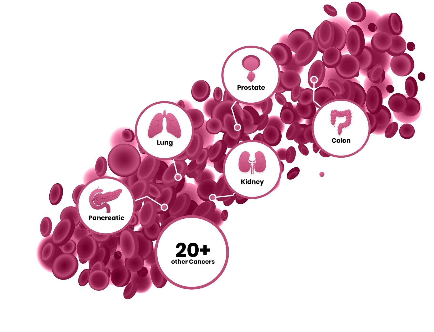 OneTest™: Artificial Intelligence-Driven Early Detection for Multiple Cancers