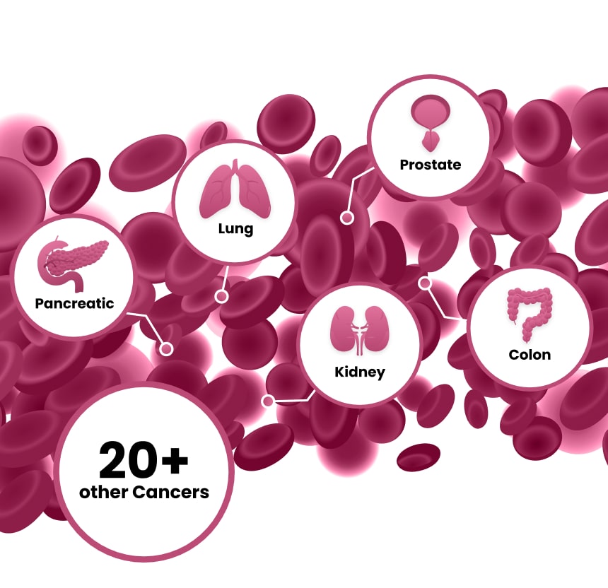 OneTest™: Artificial Intelligence-Driven Early Detection for Multiple Cancers